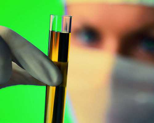 amh值低于1还能受孕吗&医院供卵需要什么,备孕5年胎停3次需要做试管吗做试管的